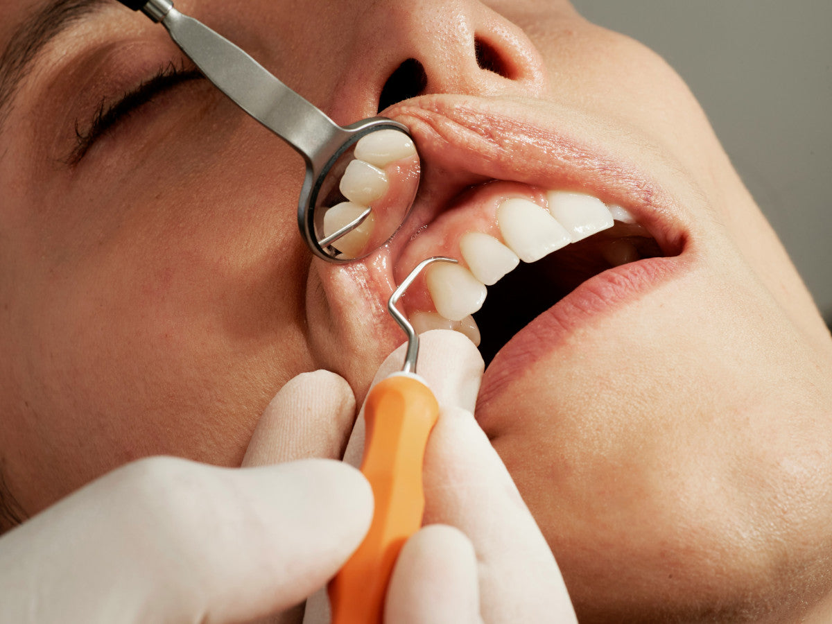 Is Nicotine Gum Bad For Your Teeth?